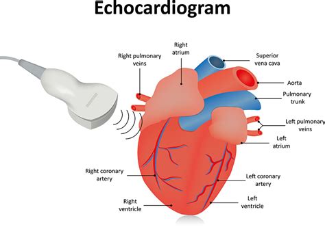 what does an echocardiogram detect.